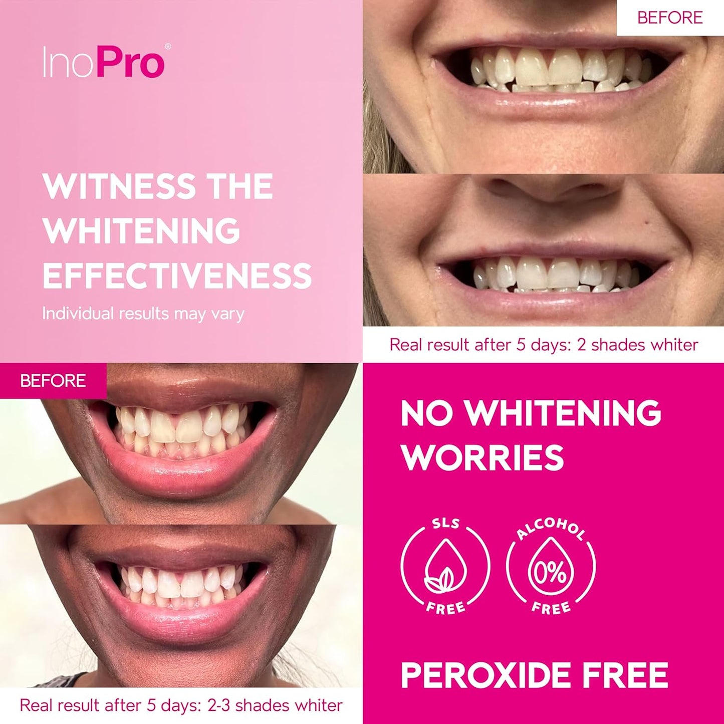 Teeth Whitening Strips 14 Treatments Kit - Teeth Whitener, Peroxide Free, Green White Strips for Teeth Whitening with Arbutin, Coconut Oil, Deep Stains Removal (28 Strips)